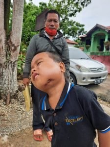 Nasib Pilu Muhammad Yasin Bocah Berumur Enam Tahun yang Lagi Butuh Perobatan 2