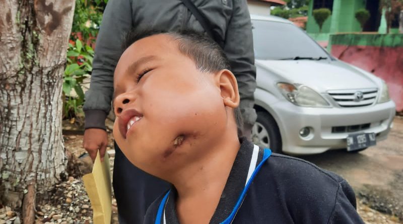 Nasib Pilu Muhammad Yasin Bocah Berumur Enam Tahun yang Lagi Butuh Perobatan 1